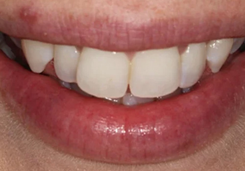 Before treatment