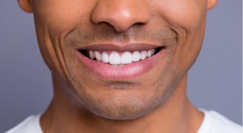 quicklink teeth whitening