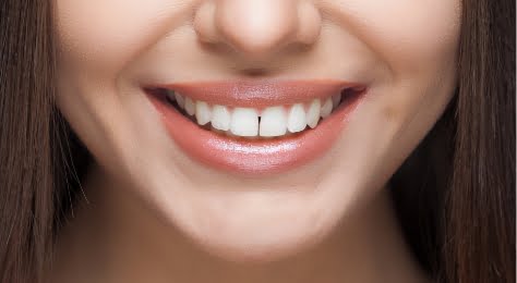 quicklink invisalign