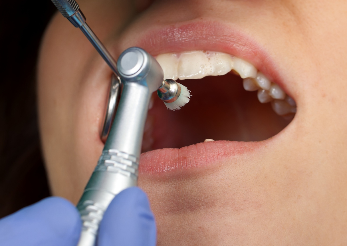 <h2>What does hygiene treatment involve?</h2>